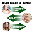 South Moon - Green Prickly Ash Herbal Mite Remover (Original)